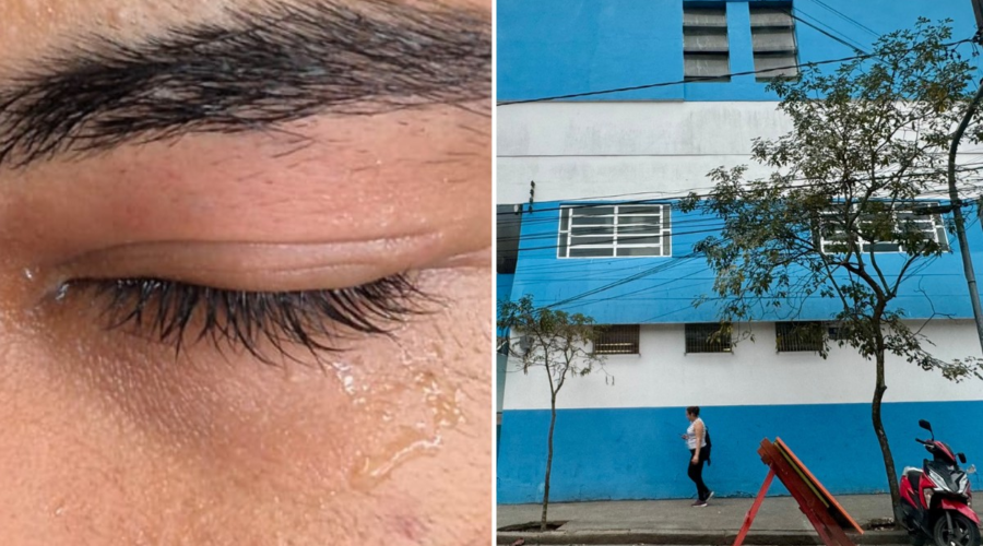 Aluno é agredido durante aula de educação física e sofre inflamação no olho em escola do litoral de SP