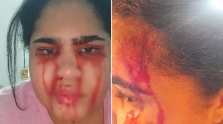 Jovem que sangra pelo nariz, boca, ouvidos e olhos passa a 'suar sangue' e busca tratamento no Nordeste