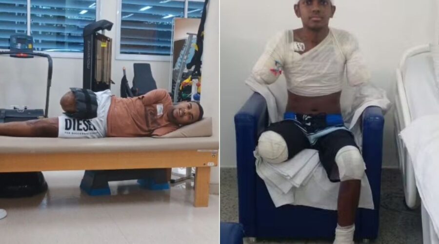 Adolescente que amputou braços, perna e parte de pé após levar choque se adapta à nova rotina: 'Muito alegre'