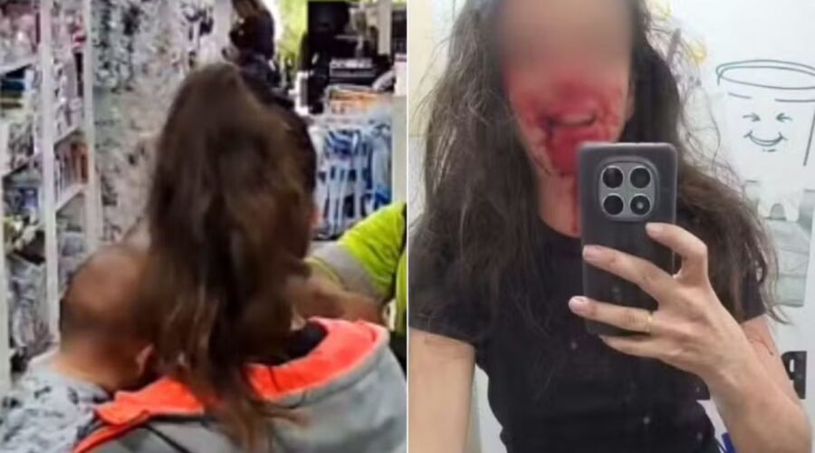 Mulher agredida por assaltante enquanto amamentava filho teme pela família: 'Ele sabe onde me encontrar'