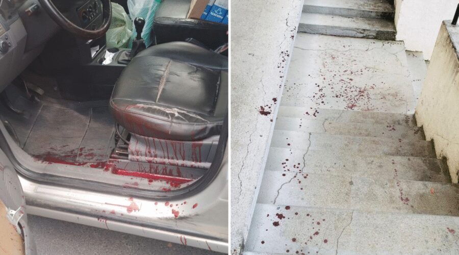 Motorista é atacado com facão após briga no trânsito, tem nervo e artéria rompidos e dirige ferido até delegacia