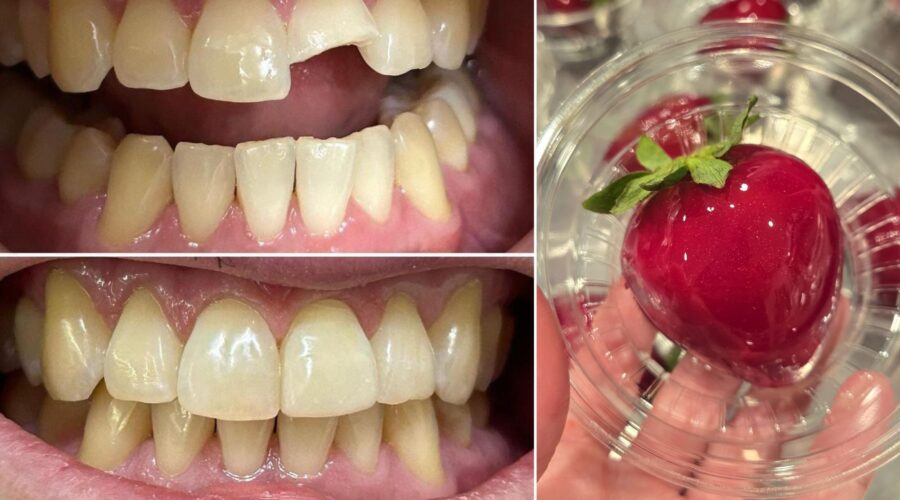 'Morango do Amor' causa fraturas dentárias e dentistas alertam: 'Bomba de açúcar'