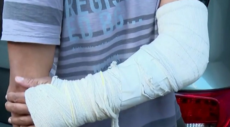 Motorista golpeado com facão em briga de trânsito rompeu artéria do braço ao tentar 'livrar a cabeça'