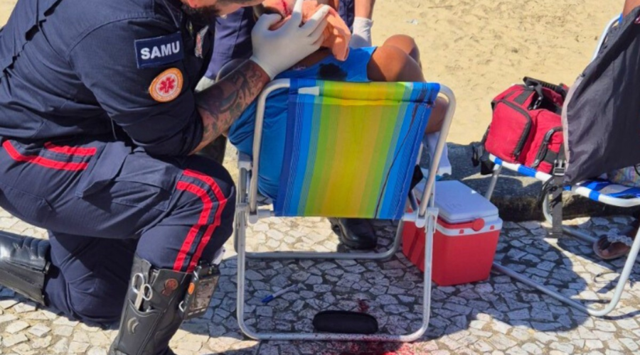 Vídeo mostra idoso levando pedrada na  cabeça enquanto observava o mar; vítima está em estado grave