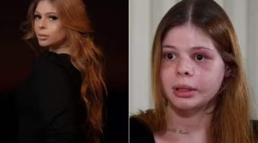 Polícia encontrou médica espancada pelo namorado fisiculturista após ouvir respiração ofegante em apartamento