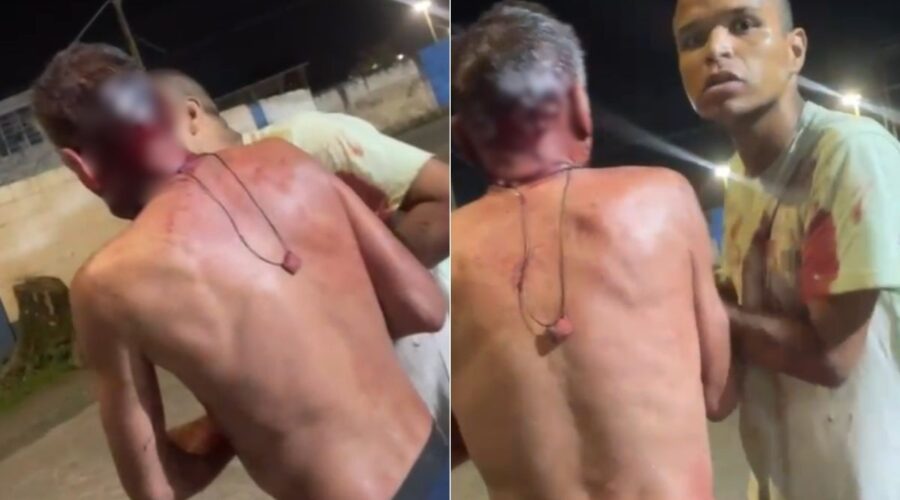 Homem tenta matar o pai com golpes de tesoura no litoral de SP; VÍDEO