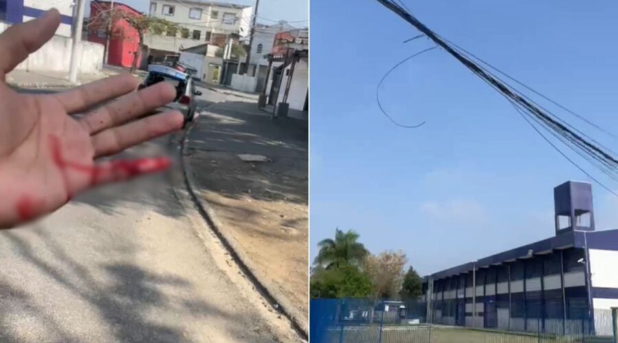 Motociclista perde parte do dedo após ficar com a mão presa em um fiação solta na rua; VÍDEO