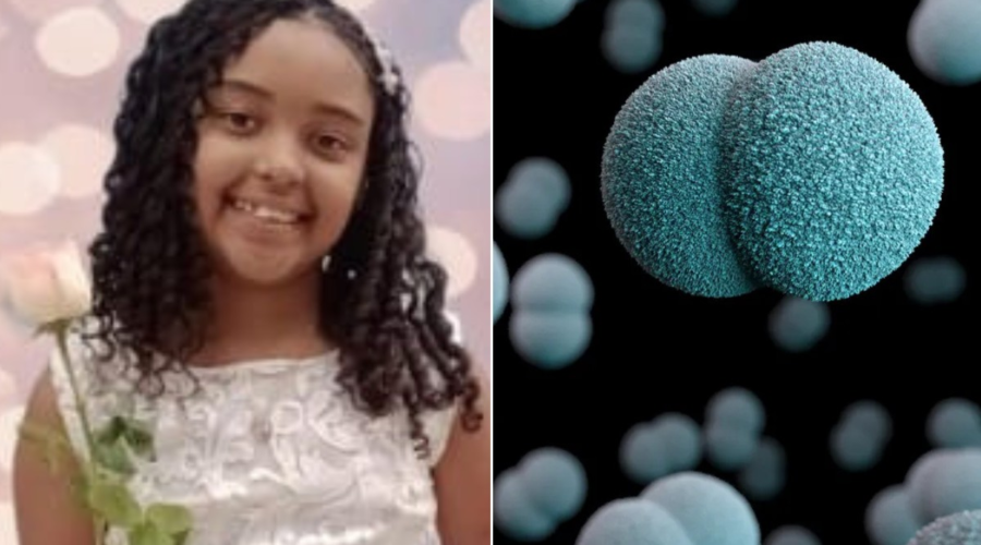 Meningite tipo C: entenda a doença que causou a morte de uma menina de 11 anos no litoral de SP