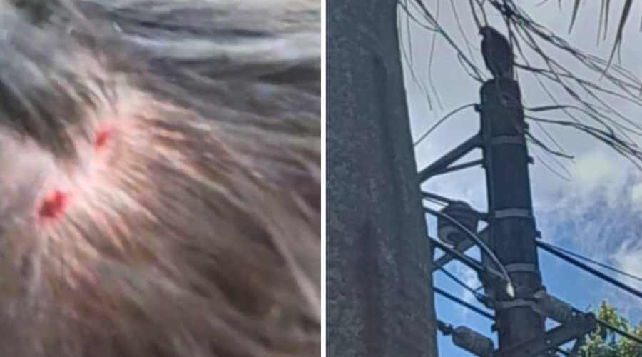 Estudante de 17 anos é atacado na cabeça por gavião em Santos; VÍDEO