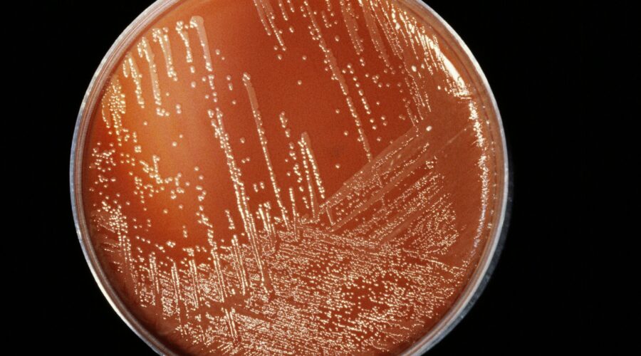 Bebê de 1 ano morre com suspeita de meningite em Guarujá e outro caso é confirmado no litoral de SP