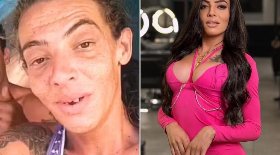 Influenciadora que viveu nas ruas faz 10ª cirurgia e exibe transformação impressionante