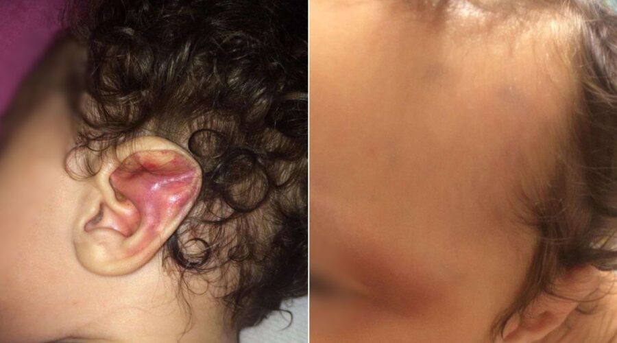 Mãe condenada a 9 anos de prisão por torturar a própria filha de 6 meses é capturada no litoral de SP