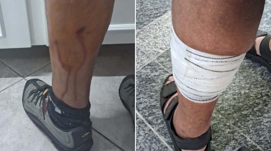 Idoso é atacado por cachorro 'caramelo' enquanto andava de bicicleta na orla da praia do litoral de SP