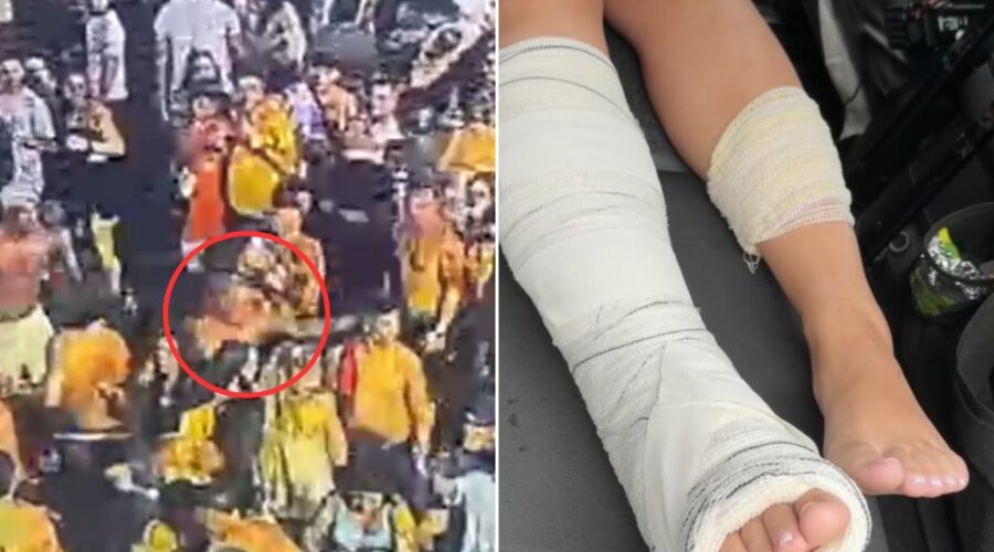 Moradora de SP baleada por PM em show de Zé Neto e Cristiano tem osso da perna atingido; VÍDEO