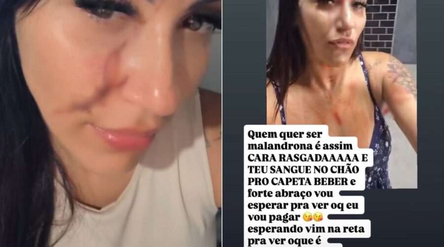 Mulher agride cabeleireira com pedaço de vidro e debocha da vítima nas redes sociais: 'cara rasgada'