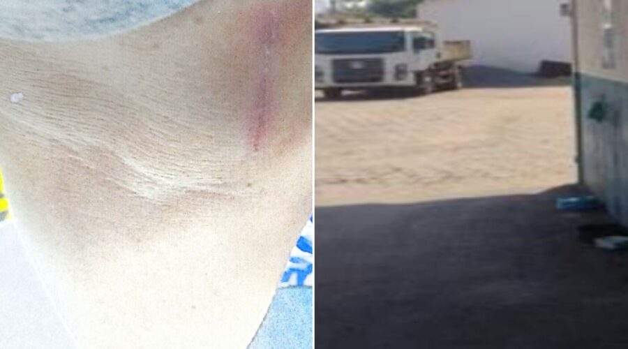 TJ-SP nega indenização a servidor agredido com enxada por colega no litoral de SP