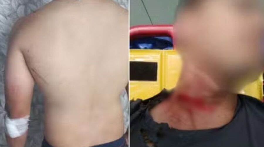 Motociclista que se acidentou após se enroscar em fiação em Santos, SP, será indenizado