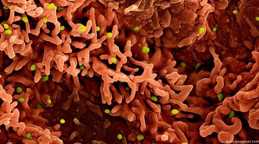 Santos confirma dois casos de mpox; veja sintomas e números em SP