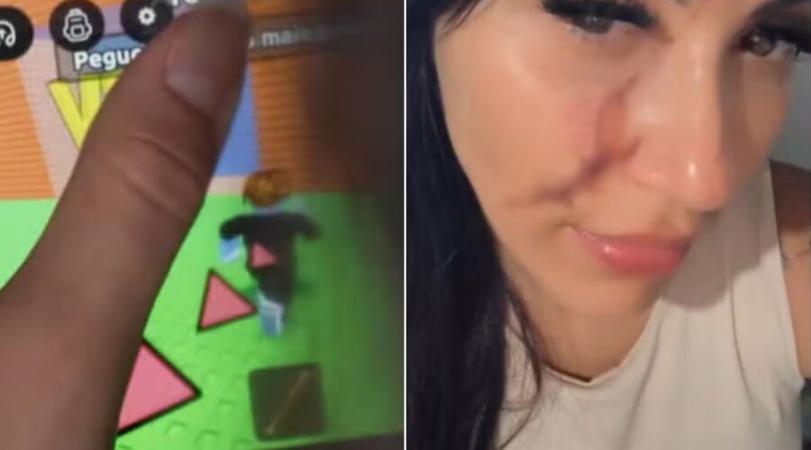 Mãe tem rosto cortado por vidro ao tentar resolver conflito dos filhos no jogo Roblox