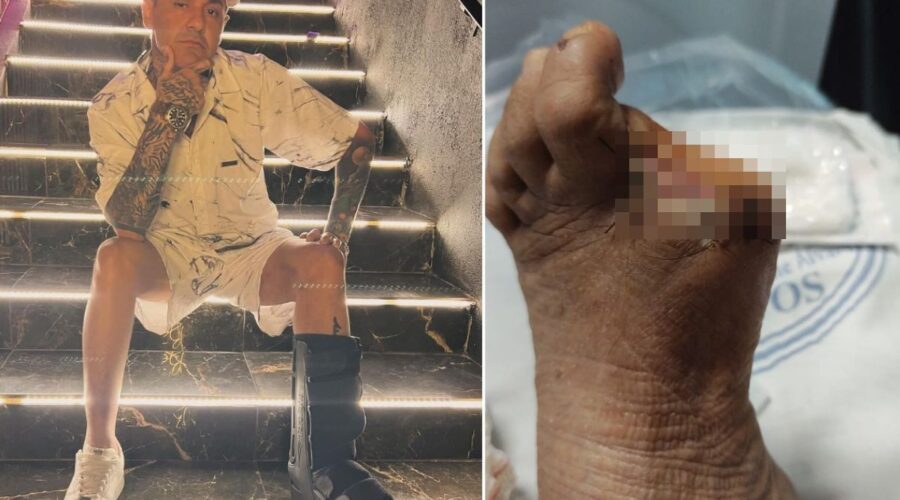 MC Danilo Boladão convivia com diabetes há mais de 20 anos e passou por amputações antes de morrer