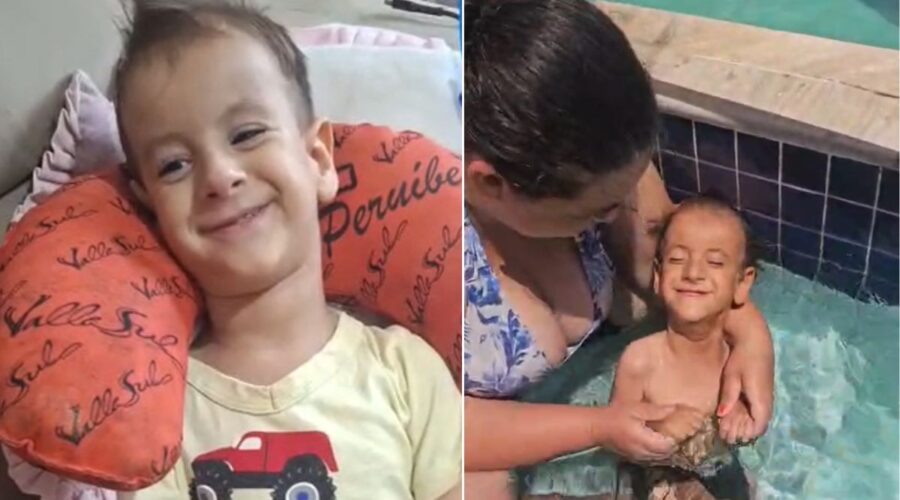 Menino de 4 anos tem doença genética rara e enfrenta dificuldades motoras no litoral de SP