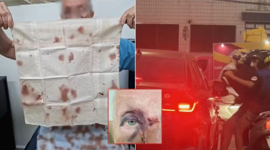 Idoso é atacado com socos e chutes de motociclistas após acidente de trânsito no litoral de SP; VÍDEO