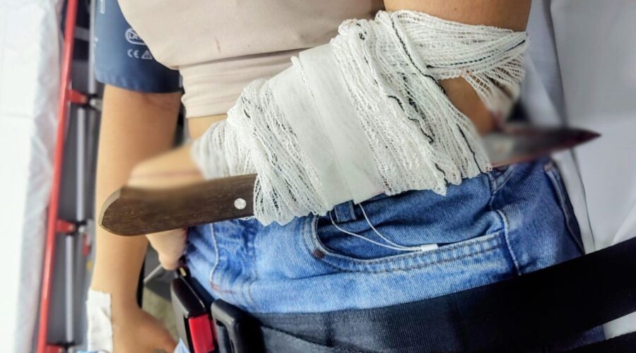 Mulher tem faca cravada no braço durante briga em bar no litoral SP