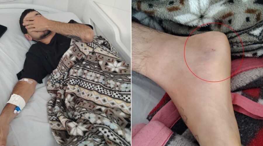 Motoboy é mordido por cobra e internado no litoral de SP
