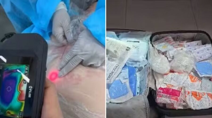 Esteticista presa em clínica clandestina é solta após pagar fiança no litoral de SP