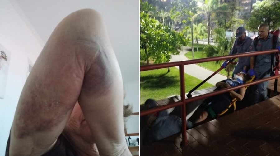 Guarda-corpo cede e mulher cai de escadaria durante exercício na orla de Santos