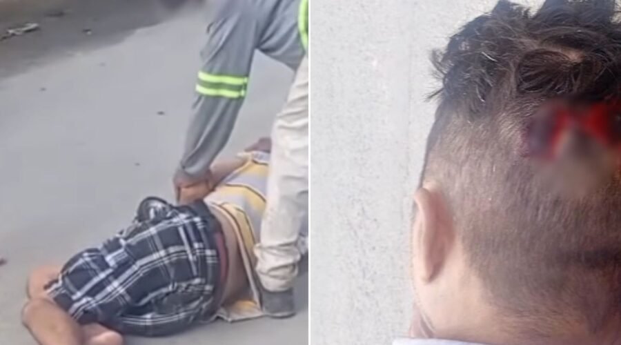 Homem cai em buraco de obra da Sabesp e sofre corte na cabeça no litoral de SP